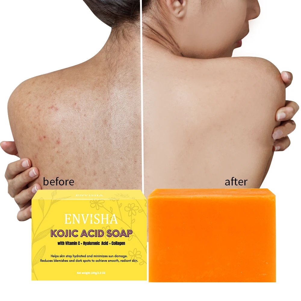 

Private label Natural Organic Whitening Kojic Acid Soap Bar Body Skin Tightening Detox Handmade Soap