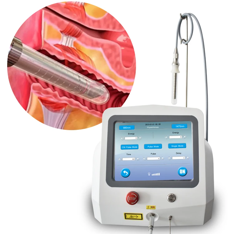 

2022 Dermatology vaginal rejuvenation 1470 980nm vagina tightening Gynecology Laser Thermal Ablation machine, White