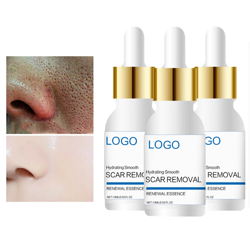 

2021 New Acne Scar Removal Serum Cream Face Care Dark Spot Removing Cuidado De La Piel Skin Repair Hydrating Smoothing Essence