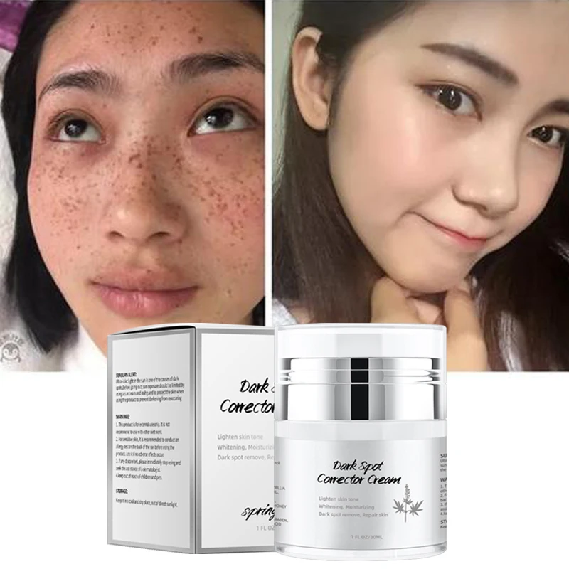 

2023 best cream dark spots whitening cream for dark spots best cream for dark spot removal