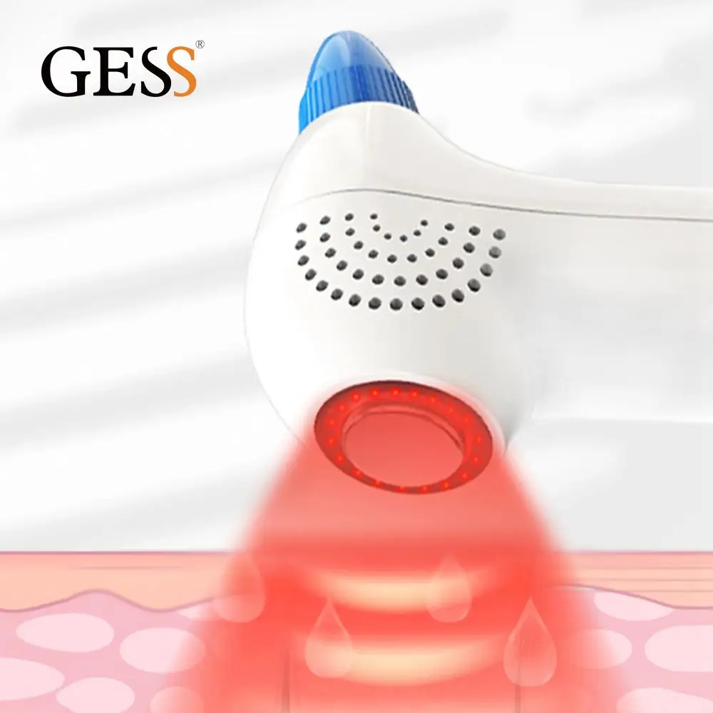 

Professional Blackhead Remover Mosen Vacuum Dropshipping, White