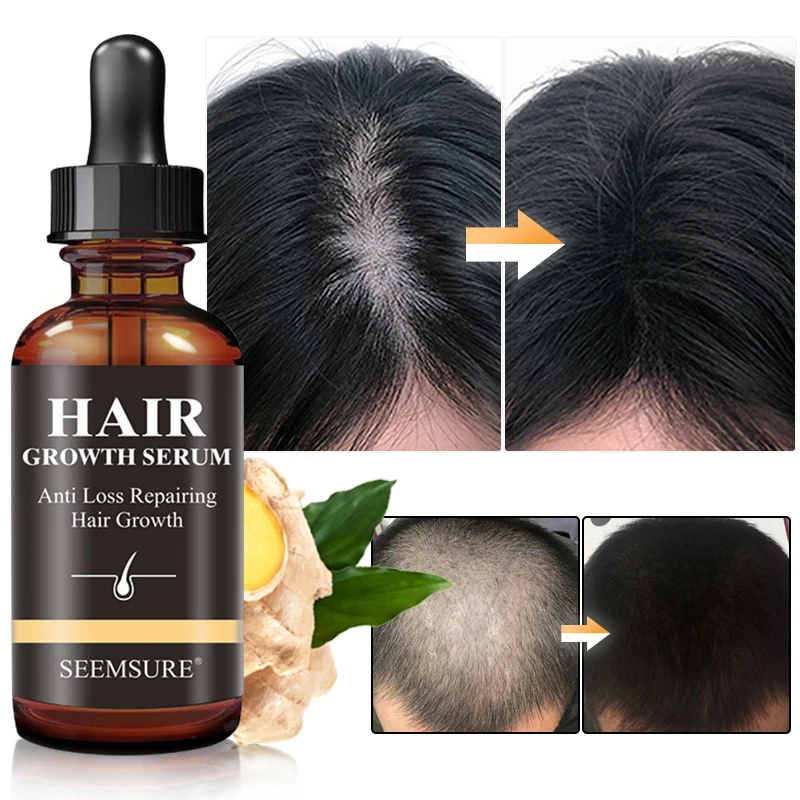 

Private Label High Efficiency Anti Loss Repairing Hair Oil Turmeric Serum For Treatment For Bald Hair Ginger Hair Growth Serum