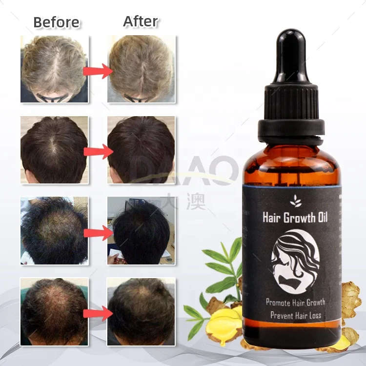 
Best Hot Selling OEM Private Label Custom Packing Essential Oil Moisturizing Natural Organic Hair Growth Castor Oil for Hair 