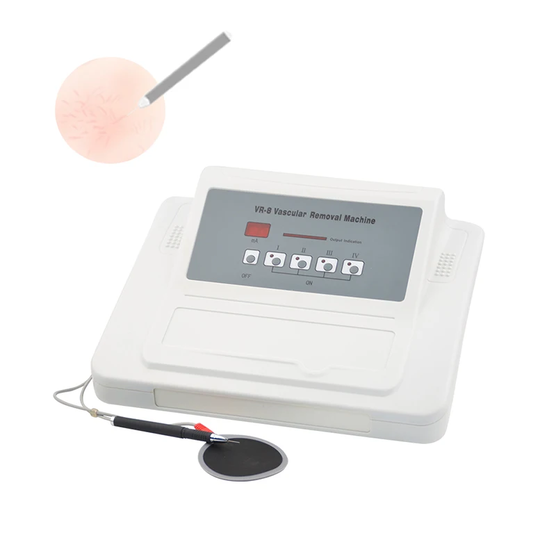 

Vascular removal beauty machine thermocoagulation thread vein removal machine / rbs vascular red spider veins removal