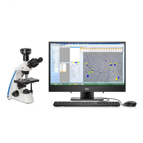 Semi auto sperm analyzer.png