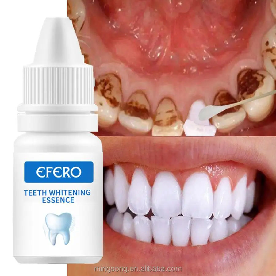 

EFERO Teeth Whitening Oral Hygiene Cleaning Serum Remove Plaque Stains Tooth Bleaching Tools Dental Care Toothpaste, White