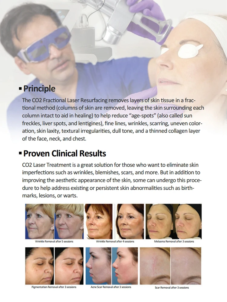 Vaginal Tightening Laser CO2 Fractional Laser For Cosmetology acnescarremoval fractional co2 laser skin resurfacing machine