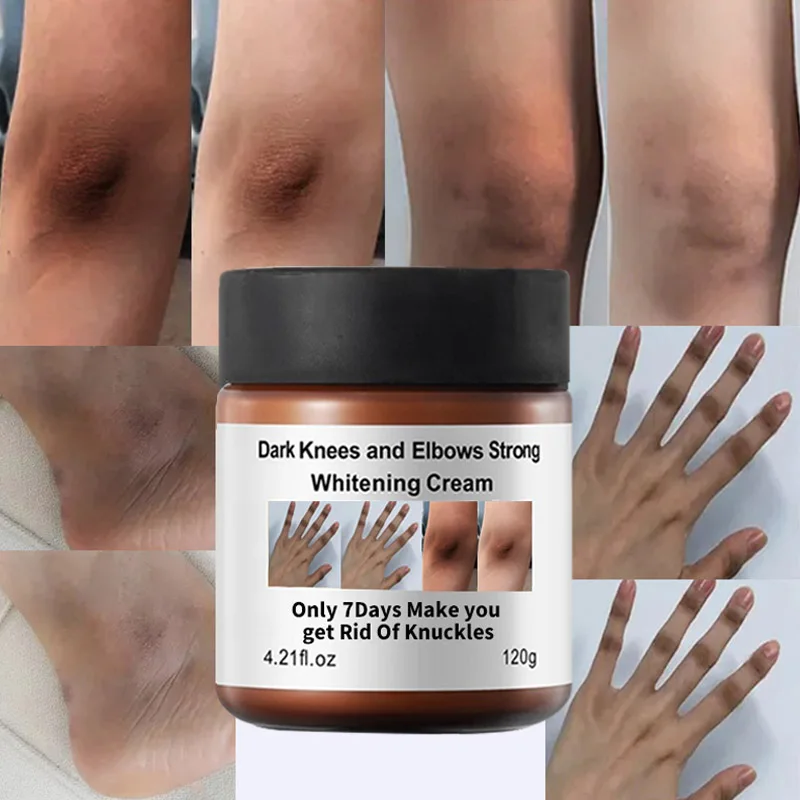 

Private Label Body Skin Care Dark Knees and Elbows Strong Whitening Extreme Whitening Cream for Dark Skin