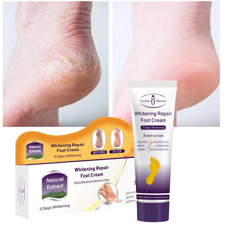 

Foot Moisturizer for Cracked Skin Dry Feet Exfoliating Foot Repair Lotion Deeply Moisturizes Healing Healthy Feet Foot Cream