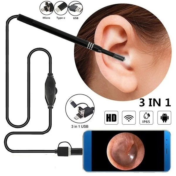 

HD Ear Endoscope Otoscope LED Camera Tool Cleaning Wax Pick Cleaner Removal Kit