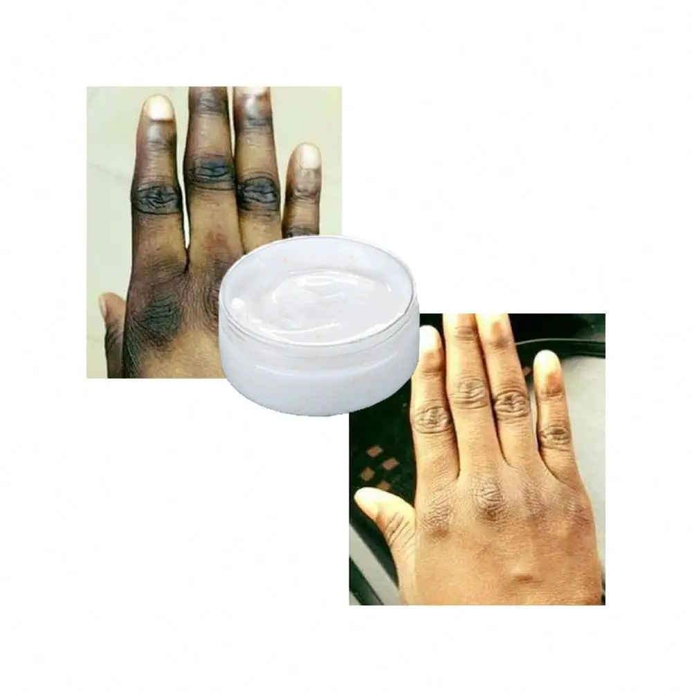 

OEM OEM/ODM Or Wholesale Exfoliating Dark Knuckle Removal Cream Bulk Ingredients