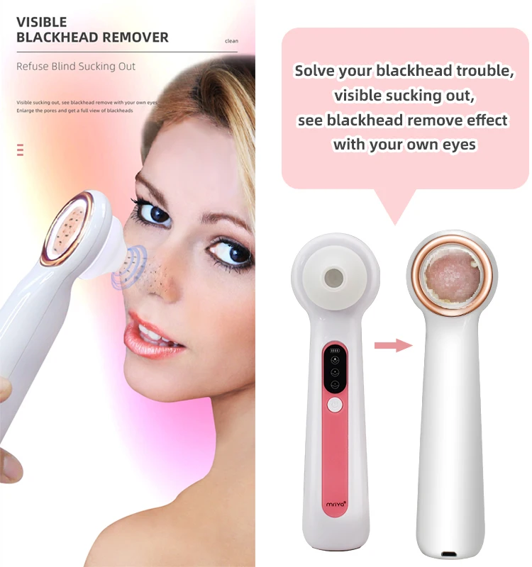 

2021 Amazon Hot Sale CE US Market Portable Electric Remover Blackheads Vacuum Blackhead Remover, White, oem color