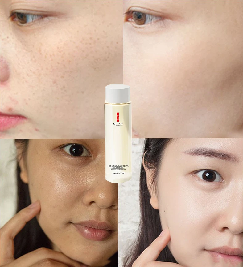 

Whitening and anti-freckle water moisturizing and diminishing spots
