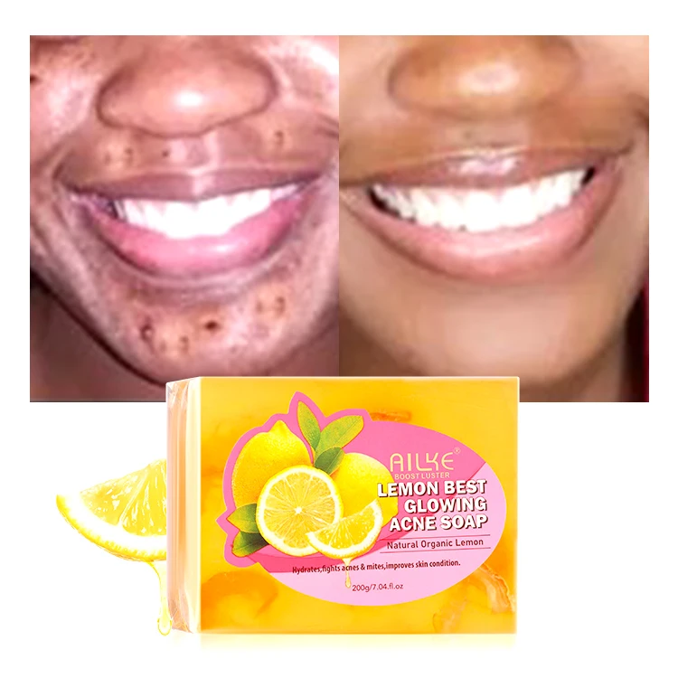 

Private Label Handmade Natural Flavor Brightening Anti Acne Body Bleaching Face Lightening Skin Whitening Lemon Bar Soap
