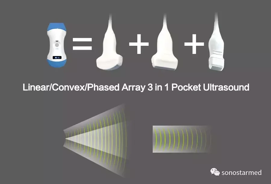 Sonostar Wireless 3 In 1 Pocket Ultrasound Cardiac Ultrasound Color Doppler Phased Array Probe