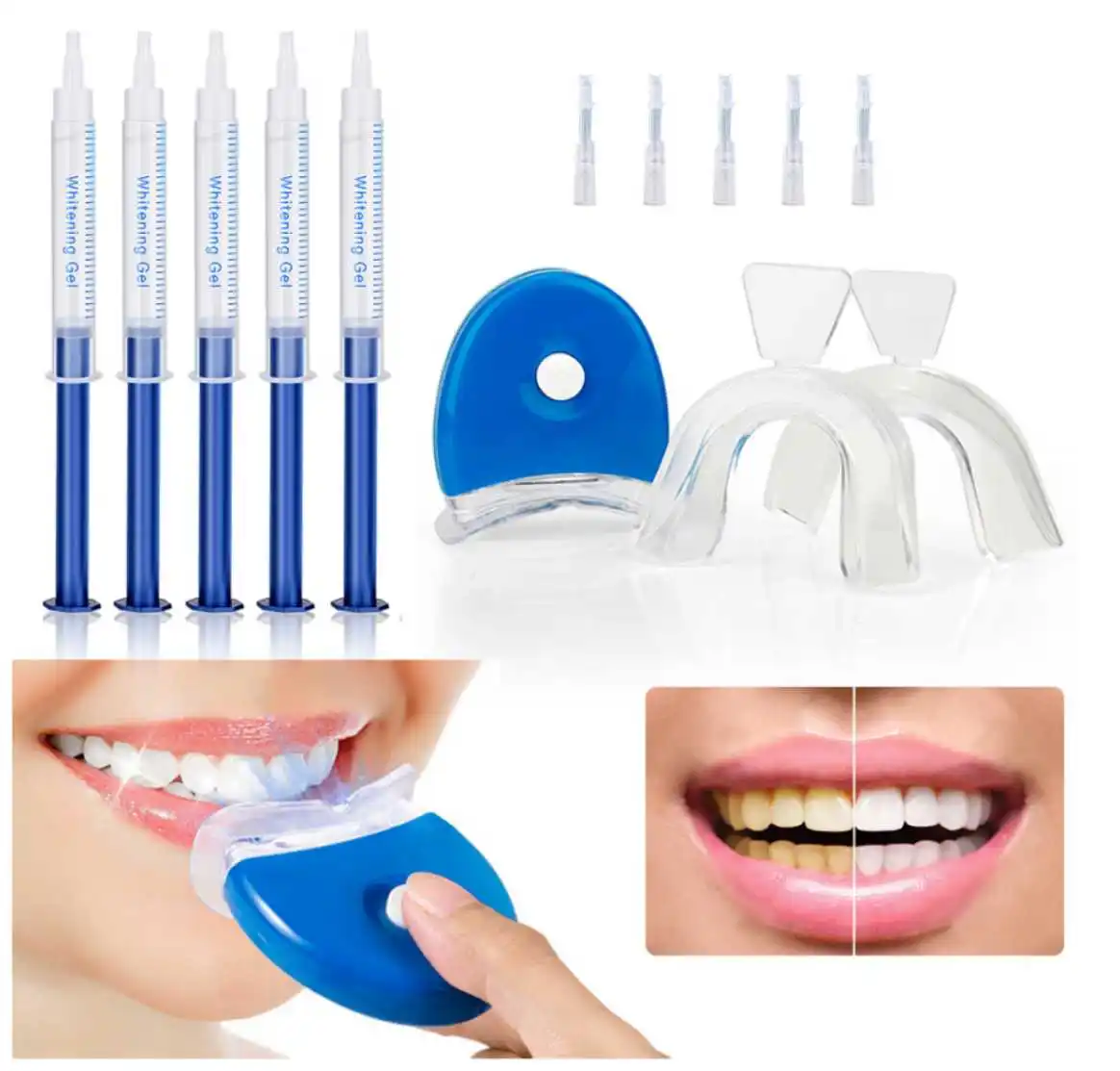 

Oxide Professional Teeth Whitening Patch 10 Teeth Whitening Glue Set, Blue