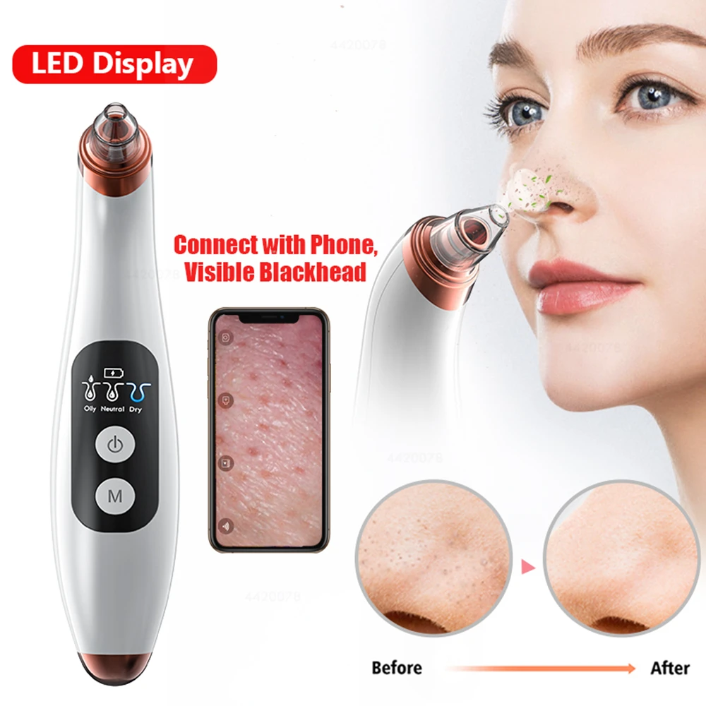 

2020 Wholesale Facial Pore Cleaner Blackhead Remover Vacuum Suction Extractor Acne Removal Tool Aspirateur Point Noir Mitesser