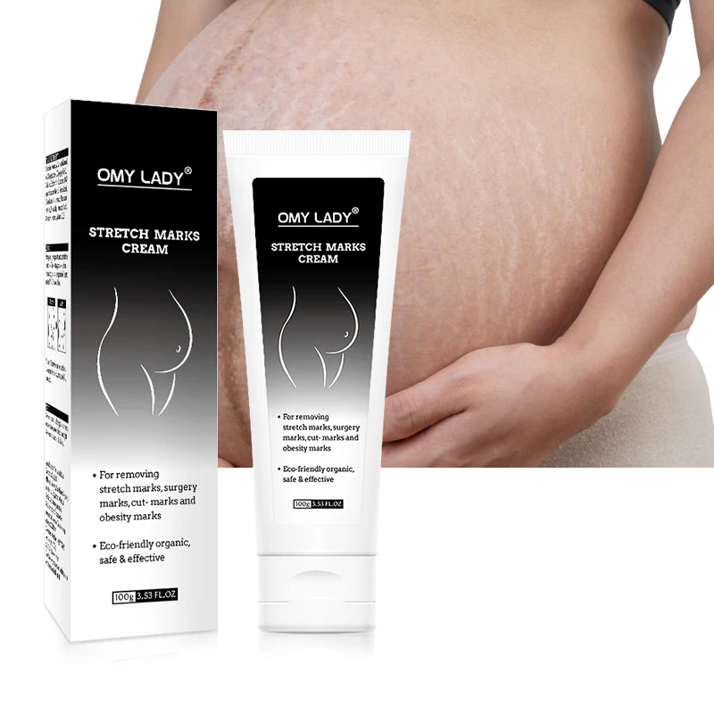 

high effect private label scar stretch marks removal cream remove pregnancy stretch mark cream