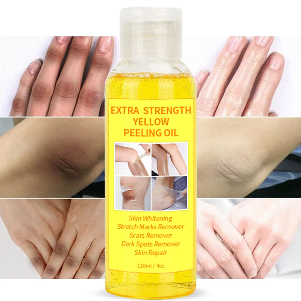 

Strong Peeling Oil Even Skin Tone Knuckle Whitening Extra Strength Yellow Peeling Oil for Dark Skin