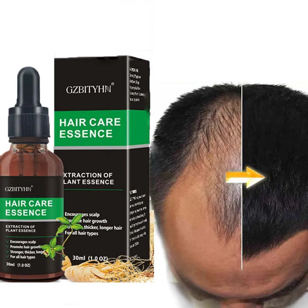 

best bald hair loss growth oil organic set product private label 7 days fast hair growth serum oil for men women, Transparent liquid