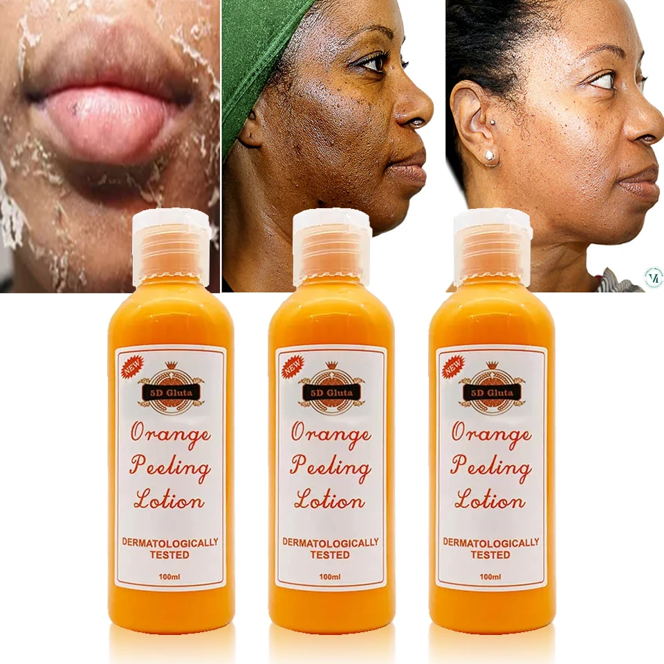 OEM Organic Peeling Serum Orange Peeling Lotion Skin Care Private Label orange exfoliating whitening gel