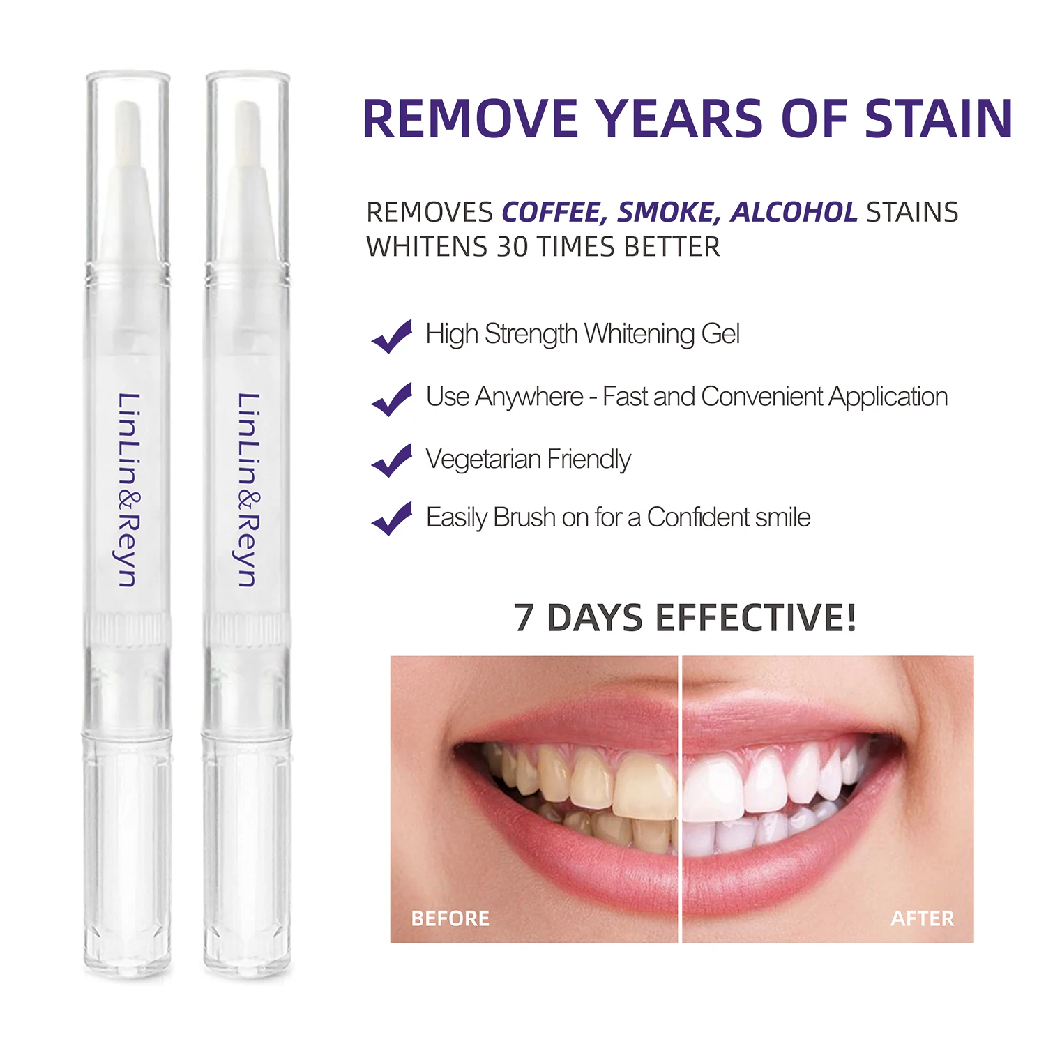 35 Carbamide Peroxide Bleaching Teeth Whitening Gel Pen Refill Gel Kit