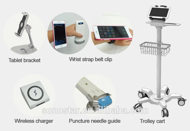 
Color Ultrasound Doppler Machine with Trolley SS-2000 Sonostar Manufacturer 