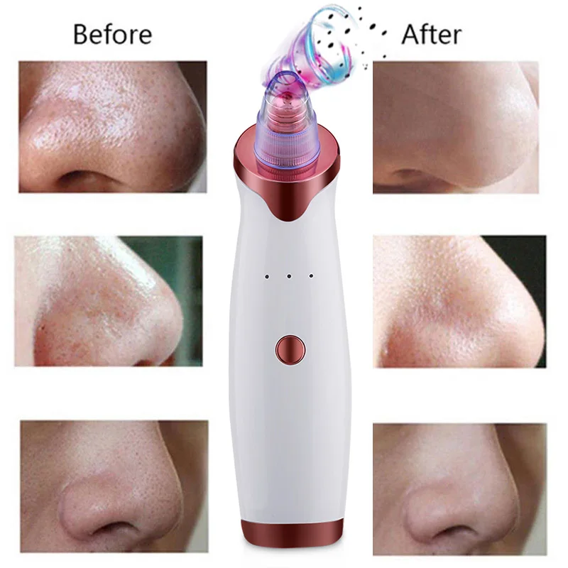 2020 Best Selling 5 In 1 Facial Pore Deep Cleaning Electric Blackhead Remover Vacuum Pore Vacuum Cleaner