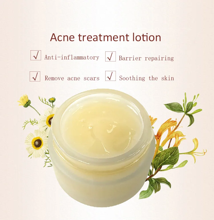 
Private Label Concentrated Molecular Solid Anti Acne Treatment Repairing Facial Lotion 