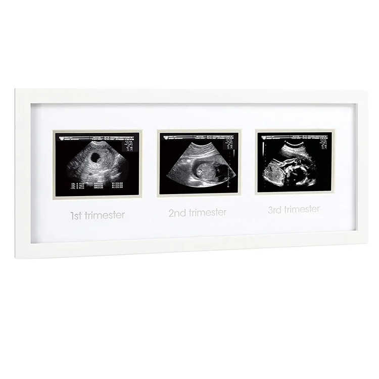 Special gifts 40x18cm baby sonogram photo frame for living room