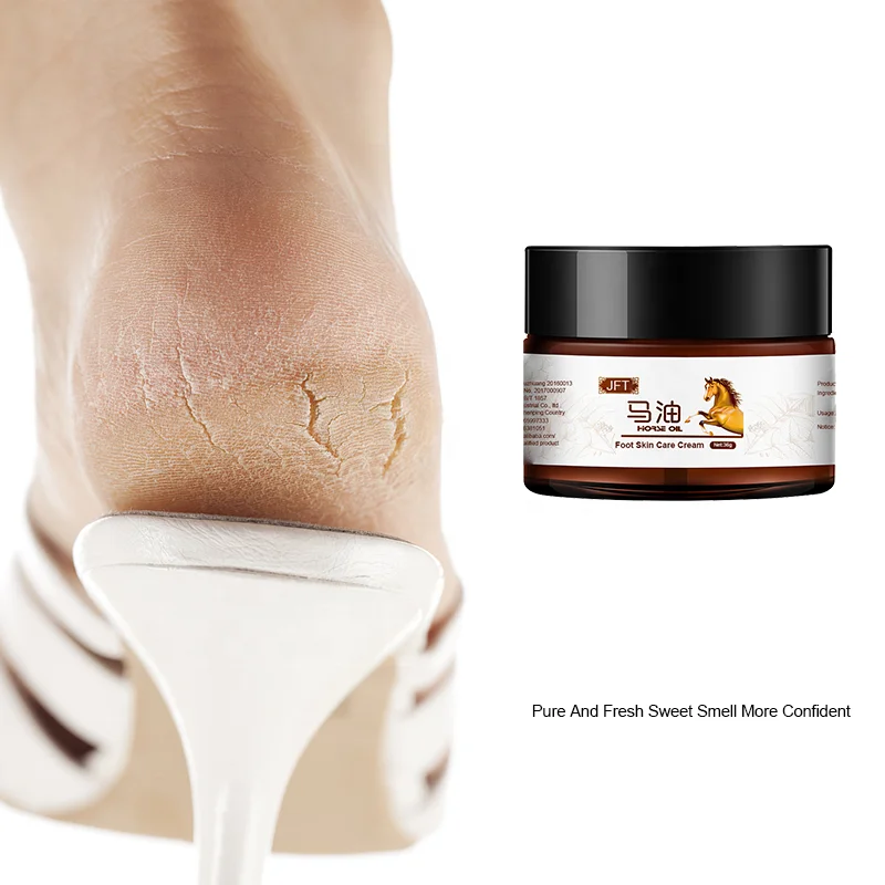 

hand and foot cream fungus tinea pedis athletes foot medicine athletes foot antifungal cream