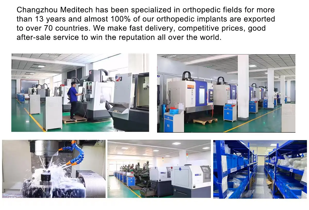 Changzhou Meditech Technology Co., Ltd. - Medical Devices(Surgical ...