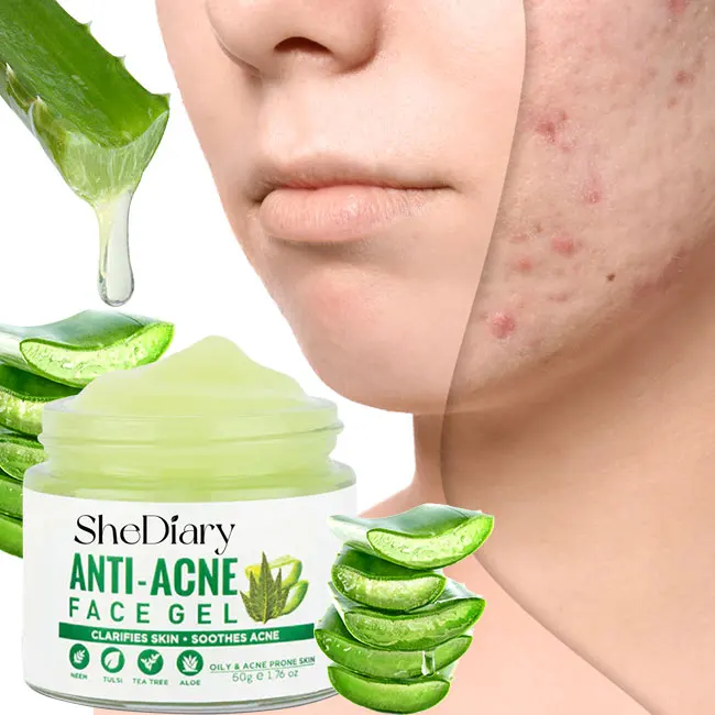 

new arrival anti aging wrinkle moisturizing creamdark spots acne removal creamcollagen whitening aloe vera face cream