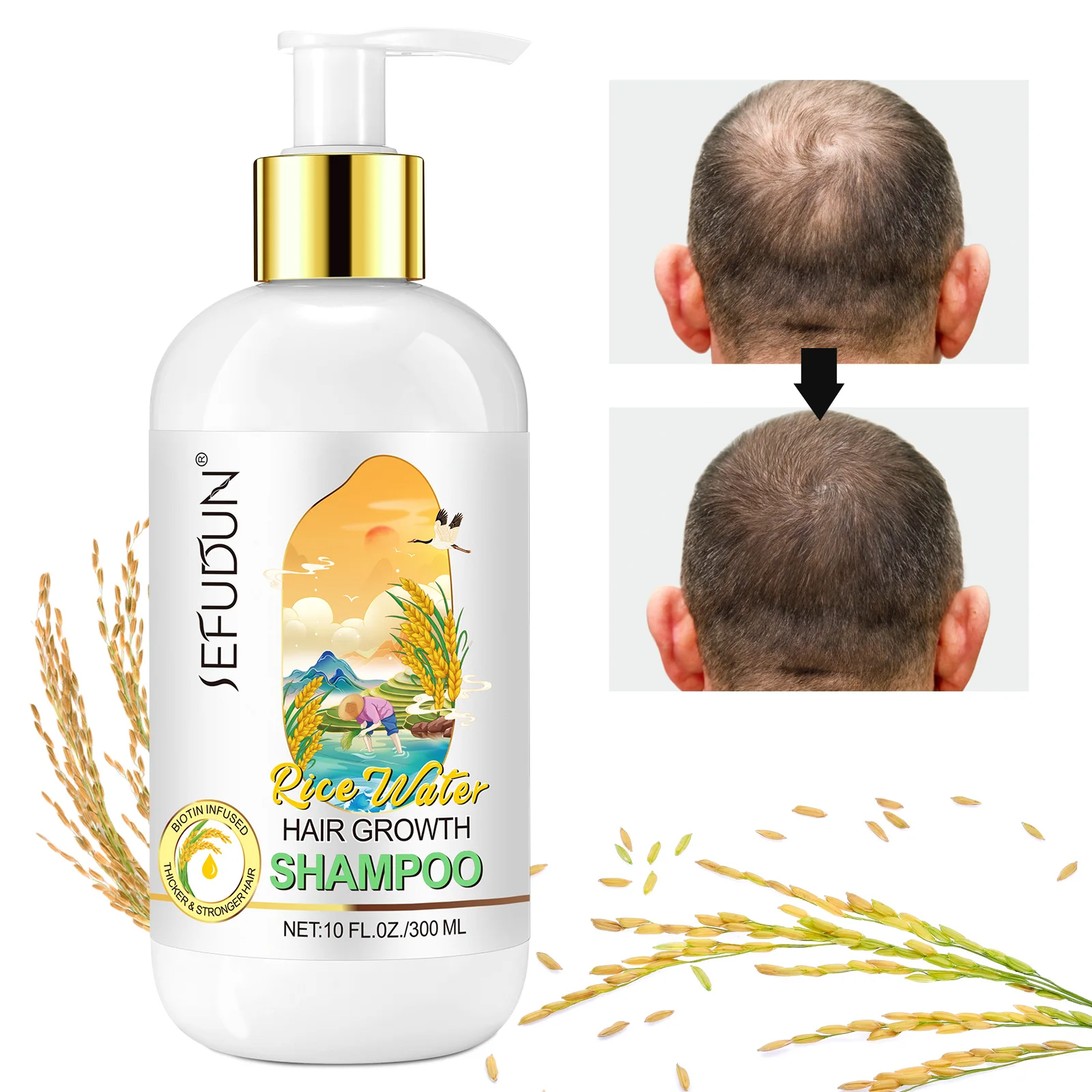 

Private Label Prevent Hair Loss Stronger Hair Shampoo Pure Organic Sulphate Free Rice Water Hair Growth Shampoo