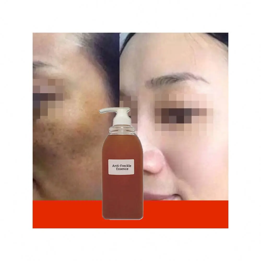 

Strong Whitening Serum Dark Knuckle Elbow And Knee 50Ml semi-finished Base
