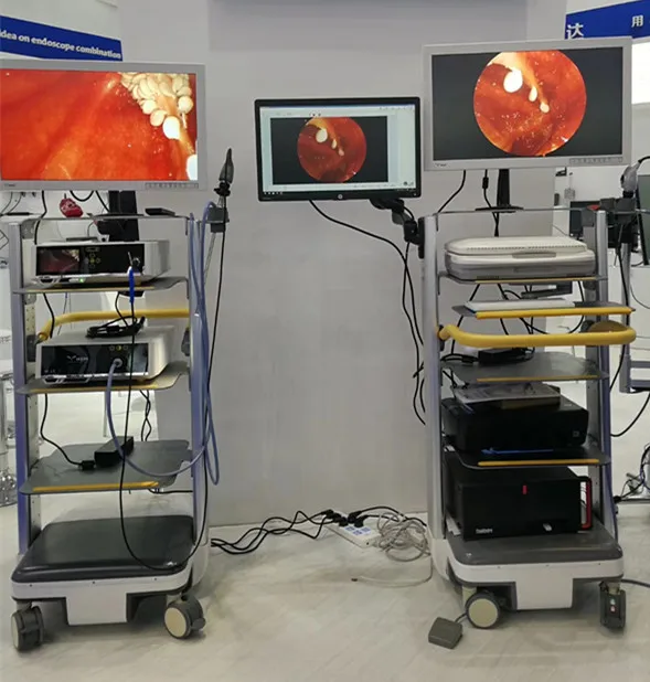 HD Endoscope Camera System