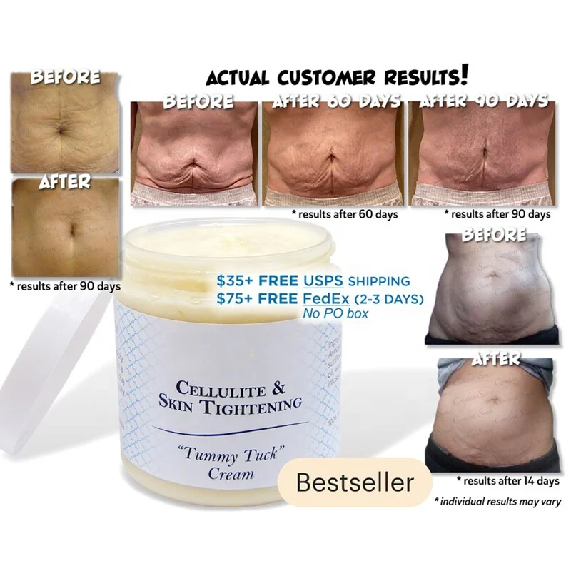 

Organic Body Cellulite and Stretch Mark Cream Tummy Tuck Tightening Stretch Mark Removal Cream