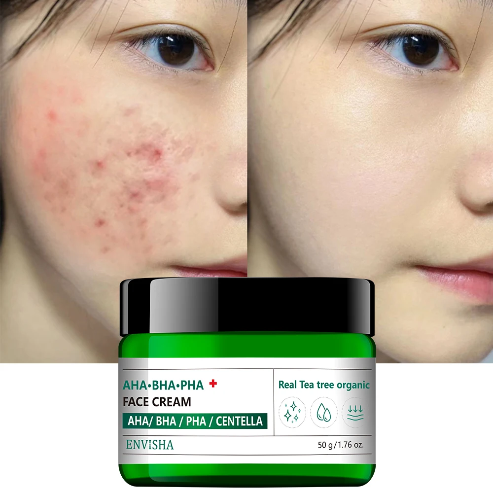 

AHA BHA PHA Tea Tree Acne Scar Removal Cream Face Skin Pimple Treatment Acne Cream