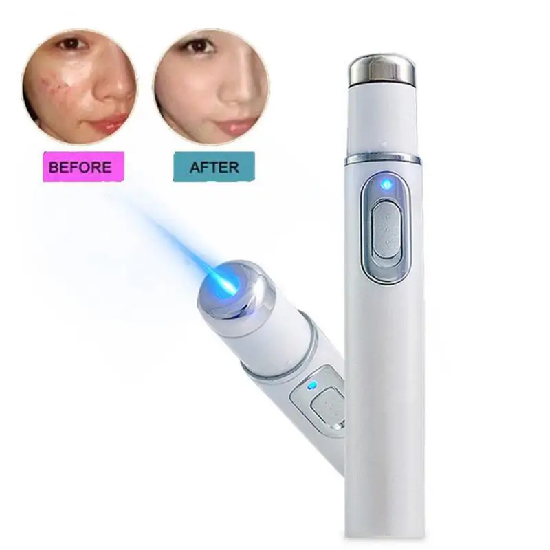 

Portable Blue Light Therapy Acne Laser Skin Spots Removal Pen Anti Varicose Spider Vein Eraser Treatment, As picture