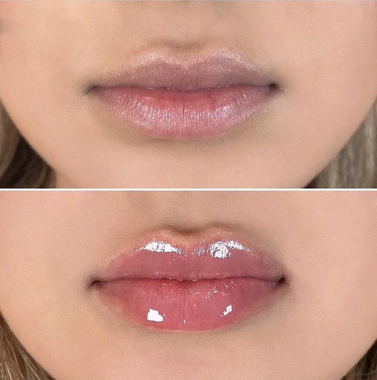 

Top ranking lip gloss plumper custom vegan collagen lip plumper gloss set private label