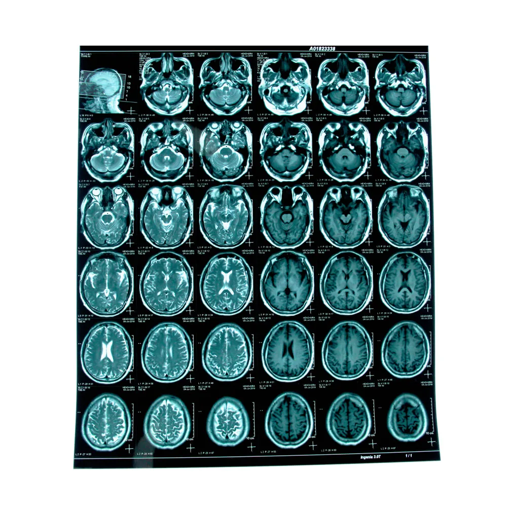 
Kodak laser x-ray film carestream dryview dvb laser imaging film for CT DR CR 