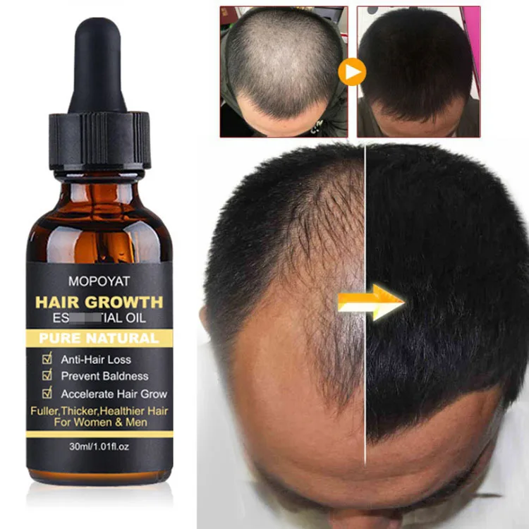

Natural Hair Growth Oil for hair care Healthy, Thicker & Longer Hair, Transparent