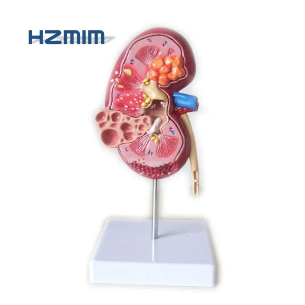 

Plastic Kidney Anatomical Model Human Kidney Model