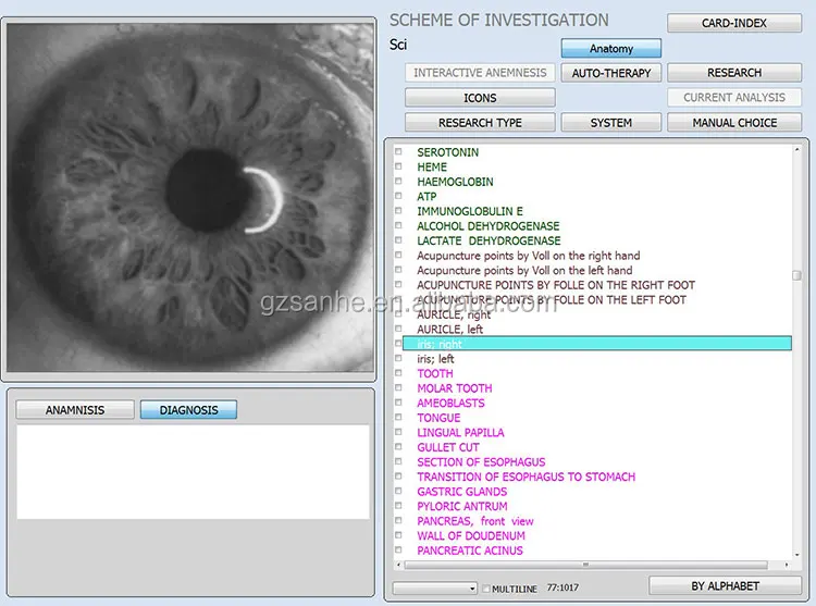 iris-analyzer.jpg