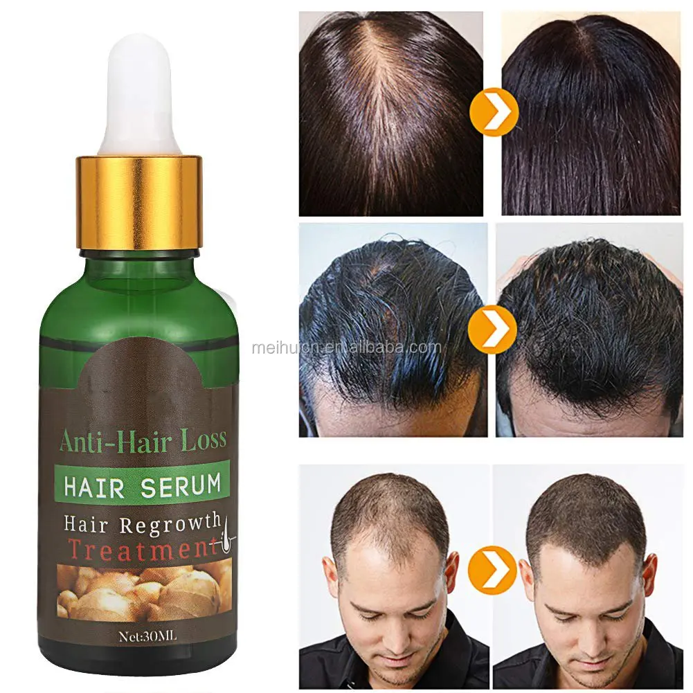 Natural Hair Growth Serum Advanced Topical Formula To Help Healthy Strong Hair Anti Hair Loss Suitable For Men And Women Buy Hair Growth Oil Hair Loss Serum Women Growth Hair Serum Product On