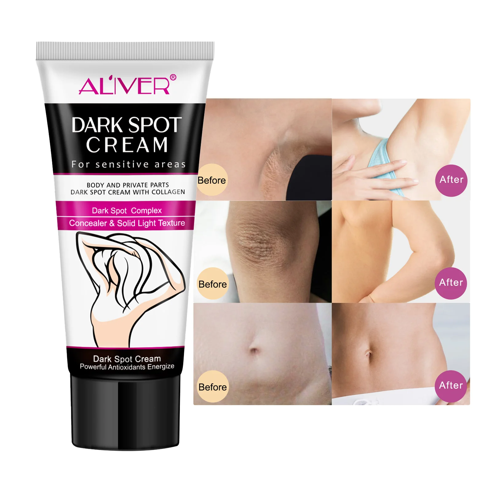 

Dark Knees Knuckles Elbows Armpit Whitening Cream Private Part Skin Strong Bleaching Cream For Dark Skin