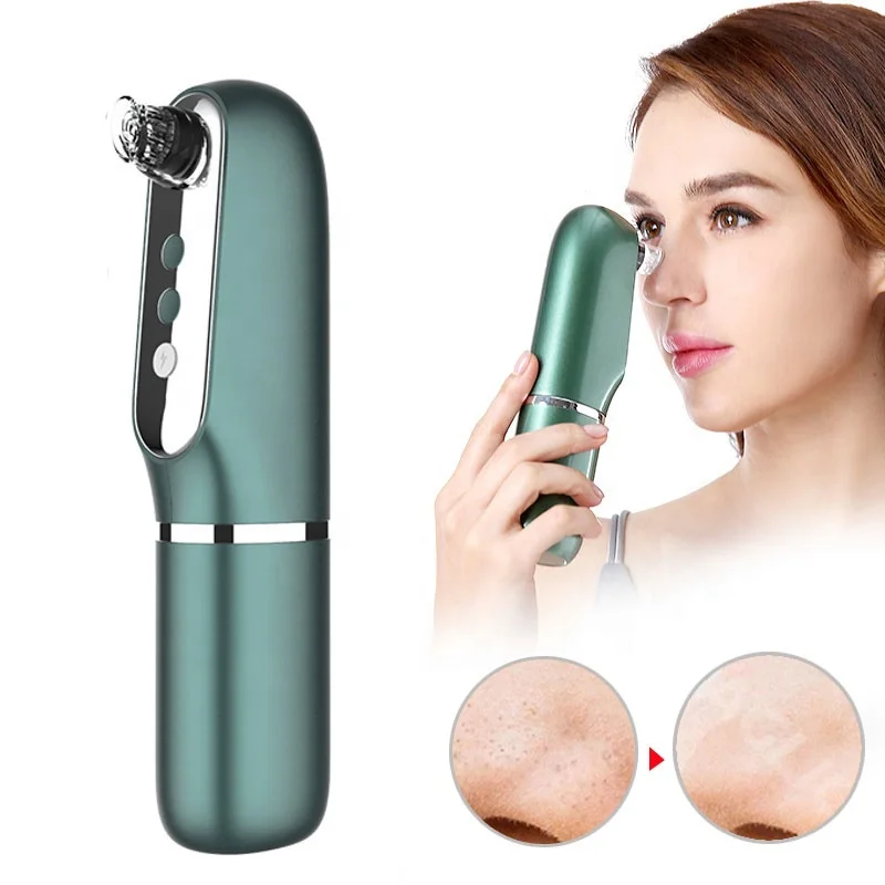 

Heating Export Deep Cleansing Black Head Small Bubble Water Cycle Vacuum Blackhead Pore Remover, White+green