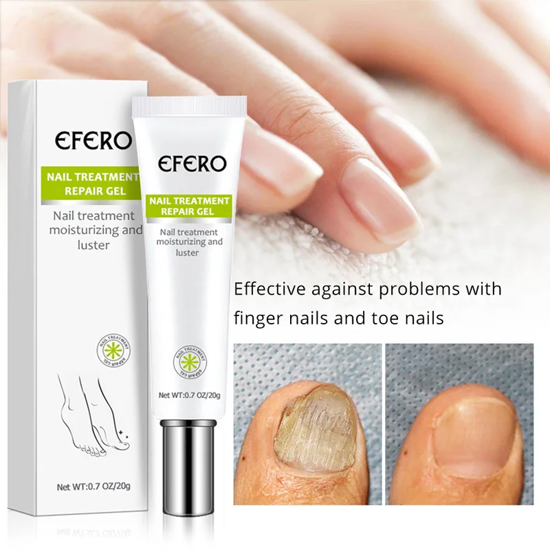 

Efero Nail Repair Dead Skin Repair Anti Fungal Nail Treatment Gel, Transparent