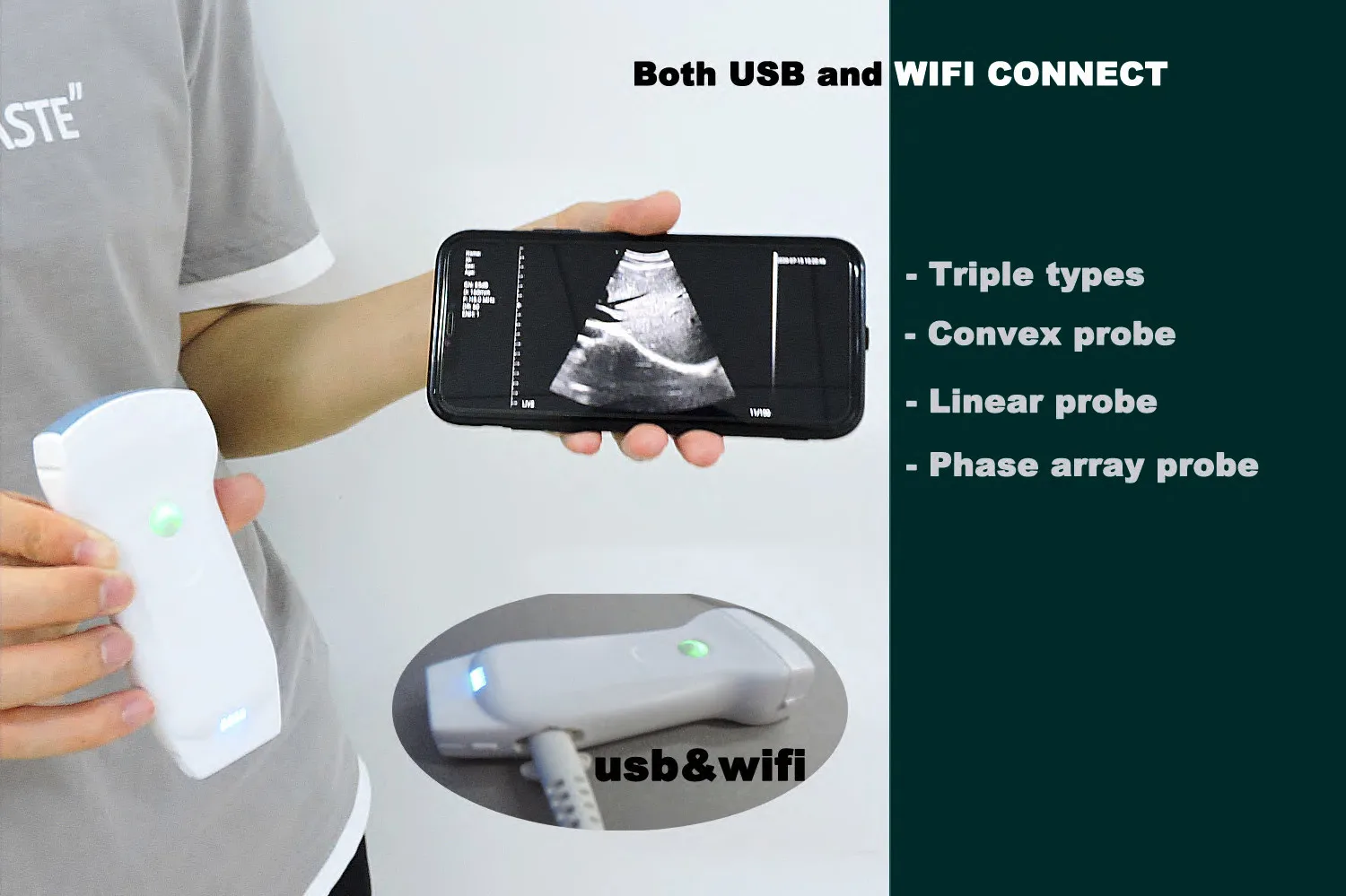 High Quality Elements In Color Doppler Wifi Usb Ultrasound Convex Linear Cardiac Double