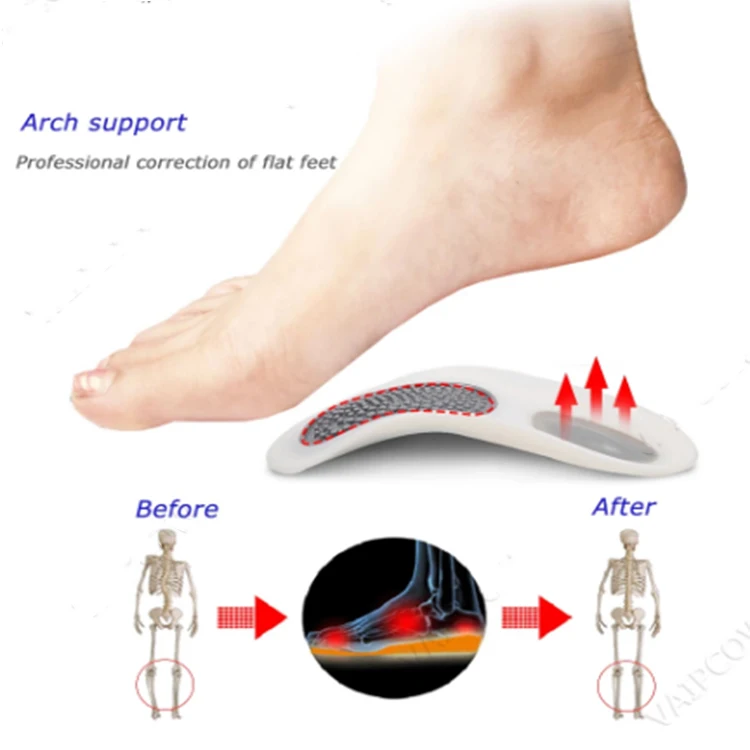 

Flatfoot Orthotics Cubitus Varus Orthopedic Insoles for Falt Feet Pads Arch Support Orthopedic Cushion Plantillas Ortopedicas
